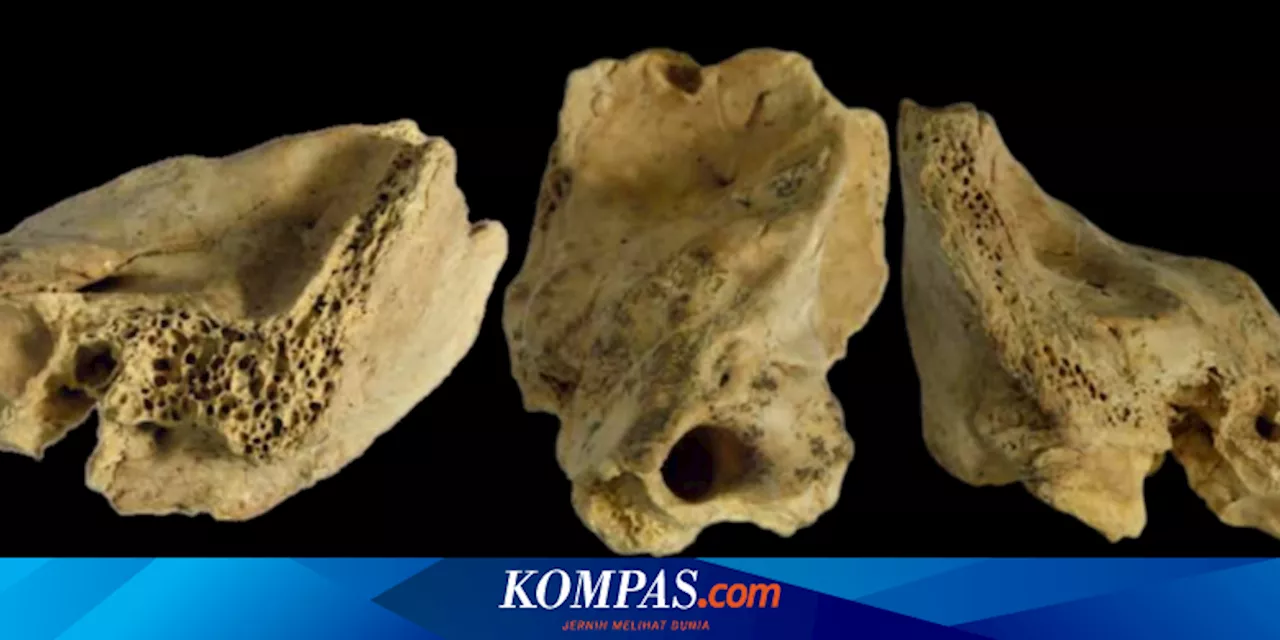 Ahli Temukan Kasus Pertama Down Syndrome pada Neanderthal