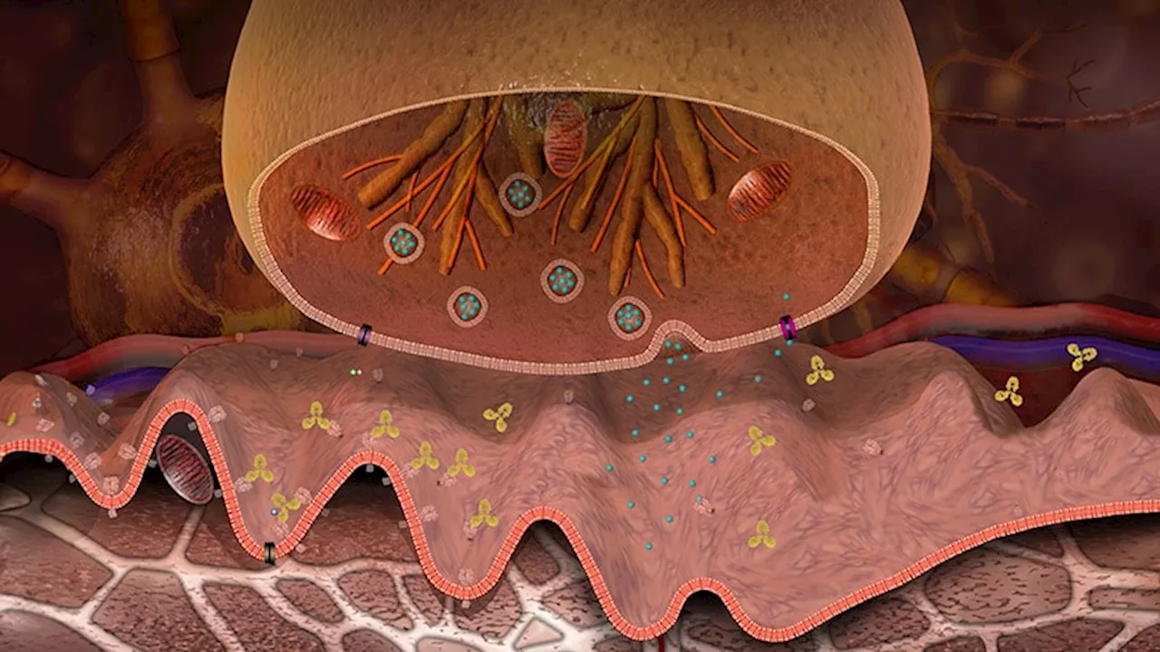 Myasthenia Gravis Treatment Strategies: 5 Things to Know