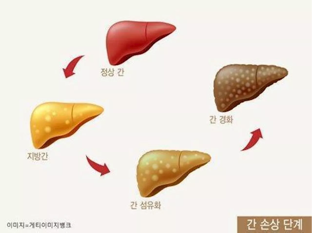 [사이테크+] '노화·스트레스로 인한 간 손상 회복 가능…생쥐실험 성공'