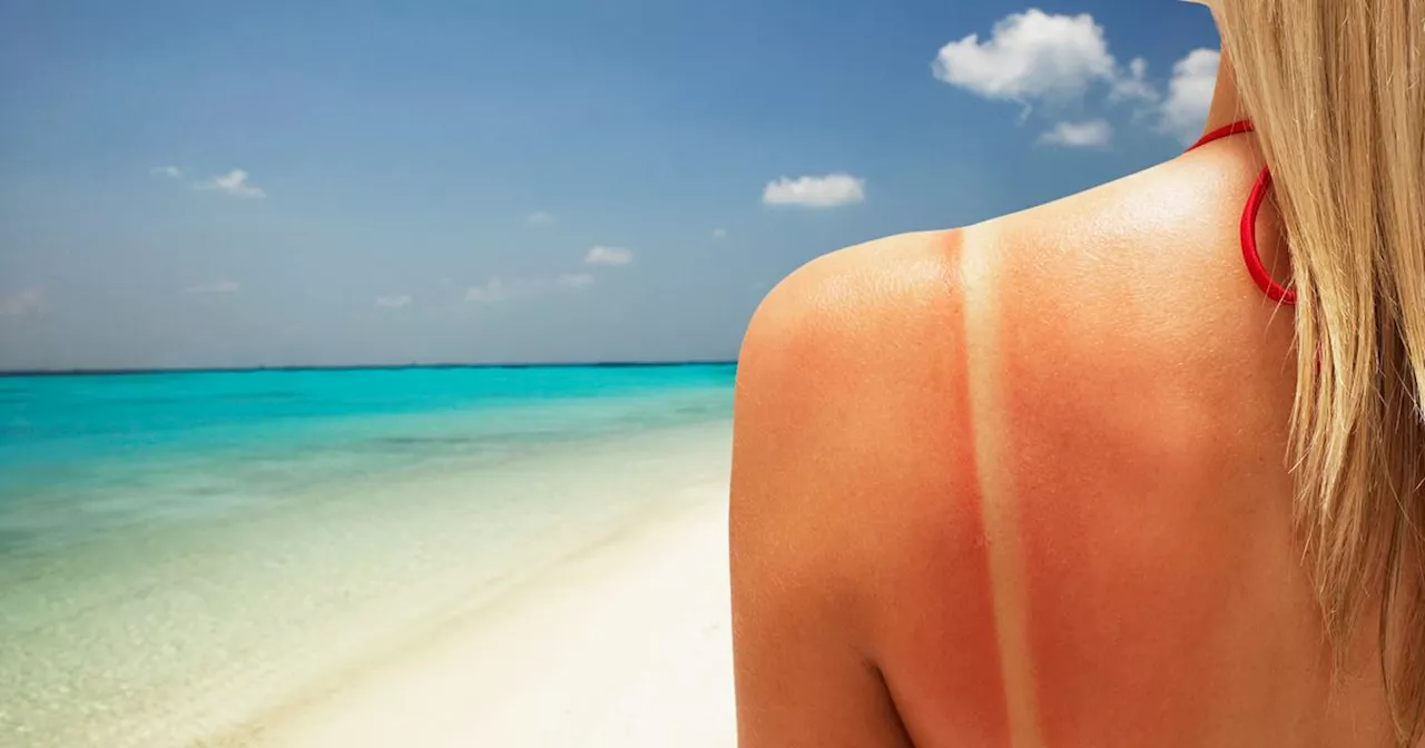 Can You Get Skin Cancer From Just One Sunburn?