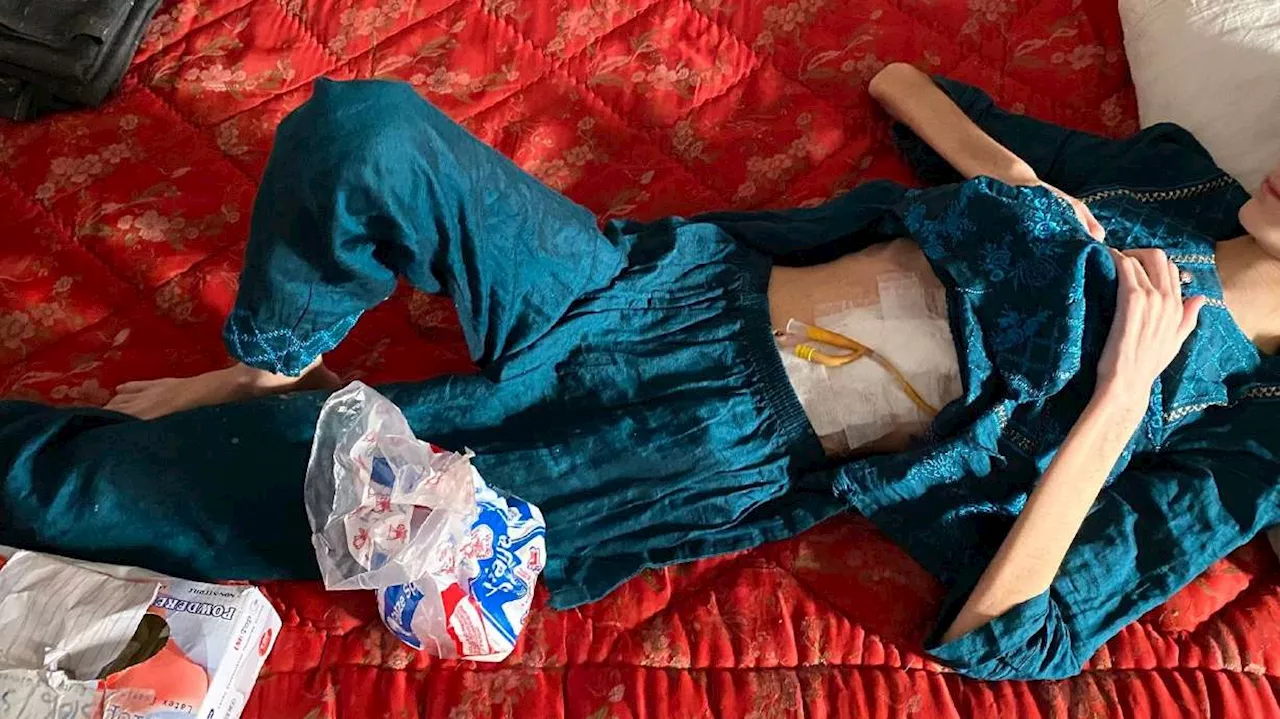 She drank battery acid to escape life under the Taliban, now she has a message for Afghan girls