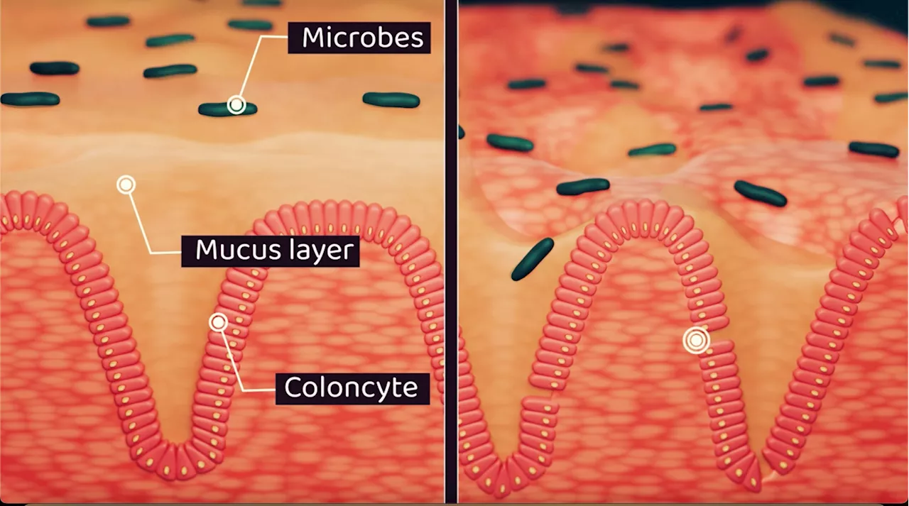 Researchers publish first computational insights into colonic motility to aid understanding of ulcerative colitis