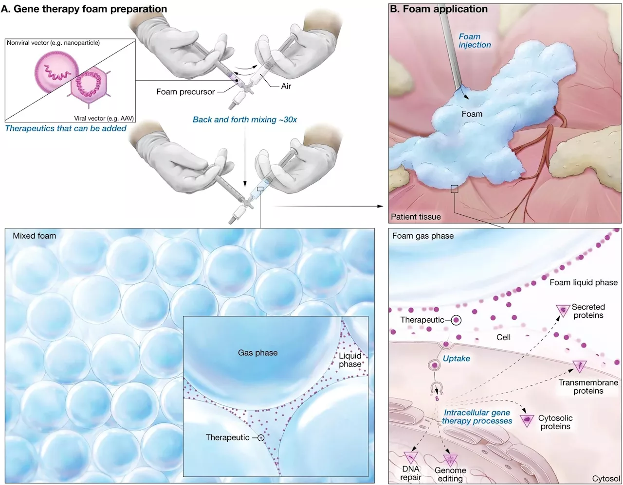 Foam technology revolutionizes gene therapy, boosting efficiency and safety