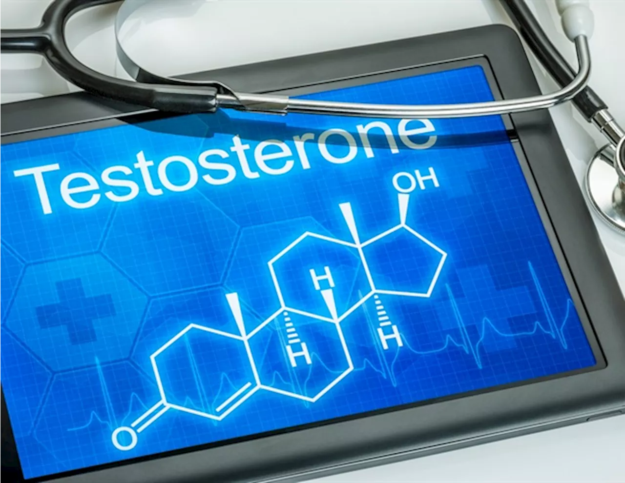 High testosterone levels appear protective against the development of type 2 diabetes in men under 65