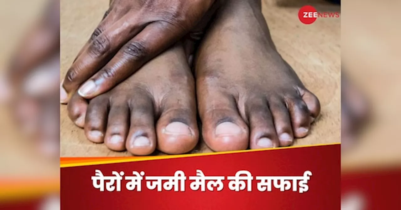 Feet Tanning: पैरो में जमी मैल की वजह से नहीं पहन पा रहे ओपन फुटवियर? 4 तरीके से दूर करें कालापन