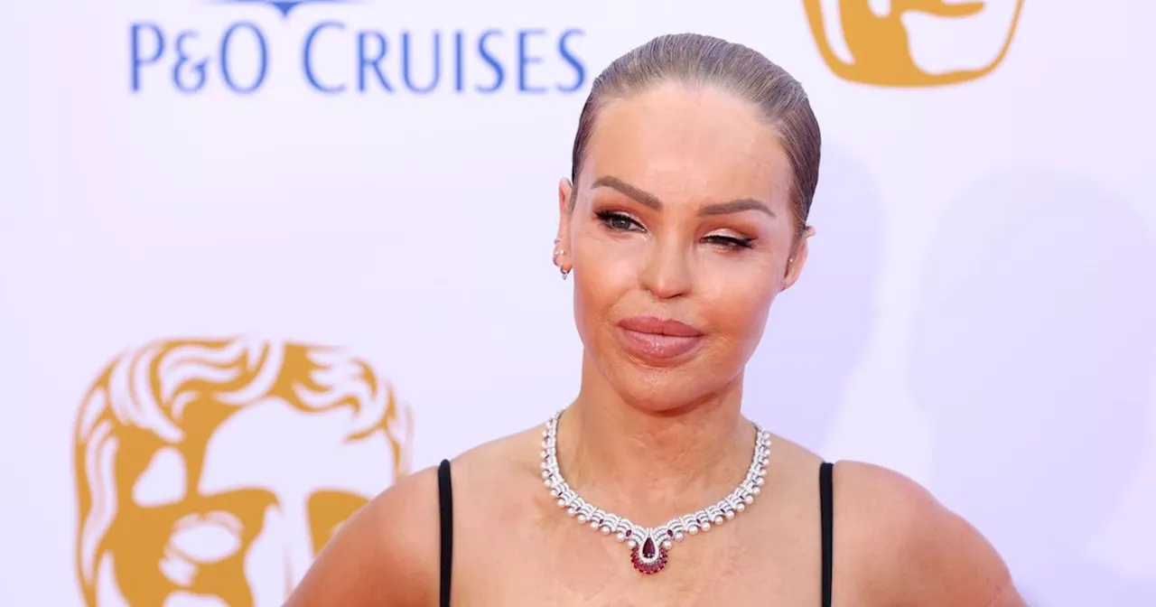 Katie Piper's acid attacker to face Parole Board in bid for release