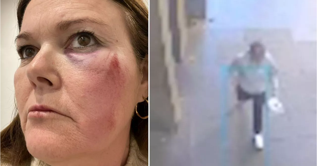 'Shocking': Woman attacked while riding e-scooter in Melbourne