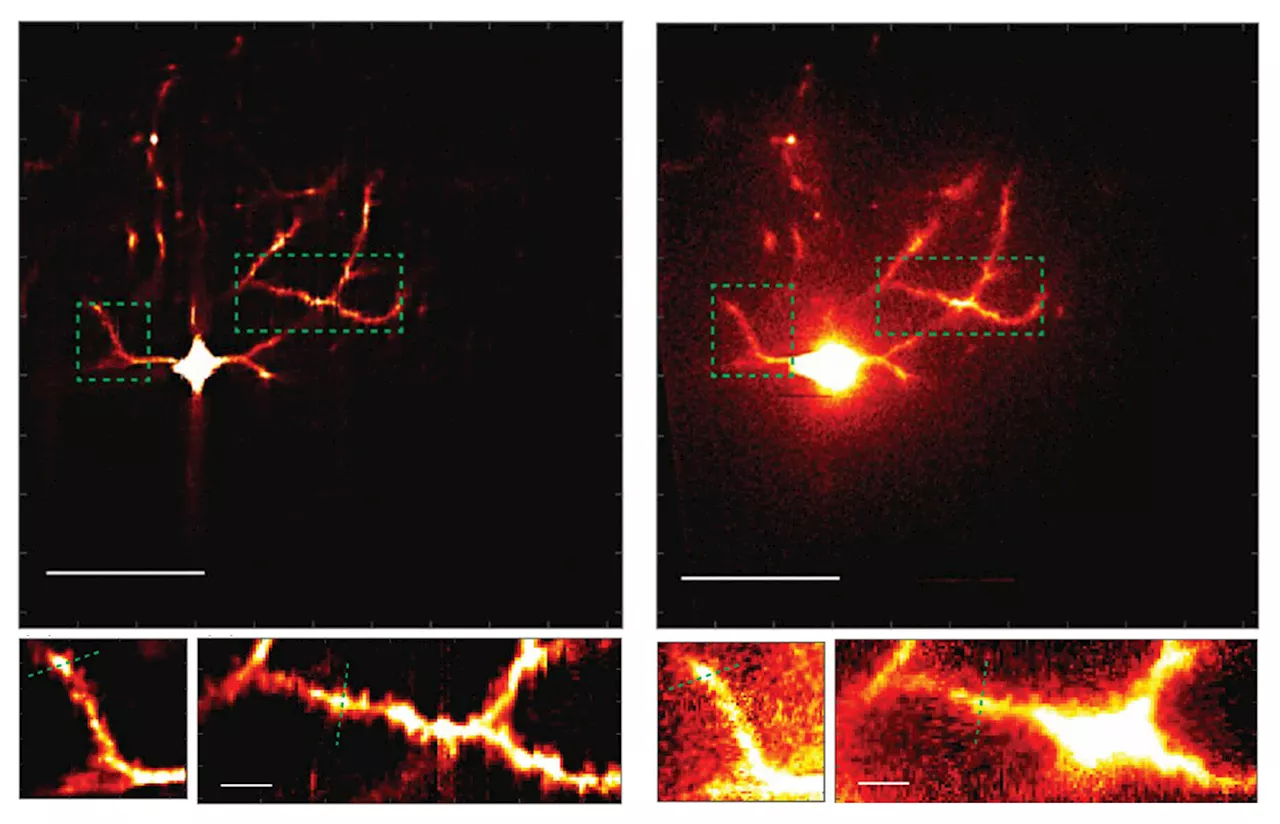 Microscope system sharpens scientists' view of neural circuit connections