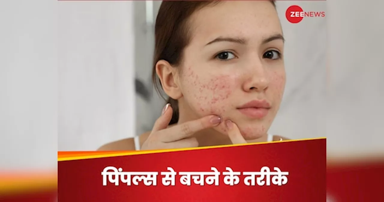 Skin Care Mistakes: इस गलतियों के कारण फेस पर आते हैं पिंपल्स, तुरंत बदले स्किन केयर रूटीन