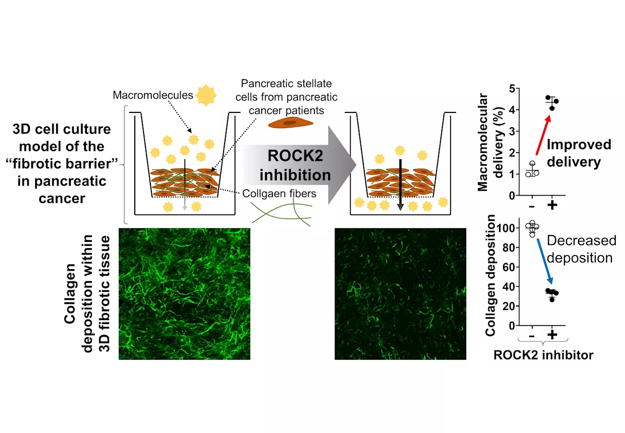 Breaking down barriers: ROCK2 inhibition facilitates drug delivery in fibrotic pancreatic cancer