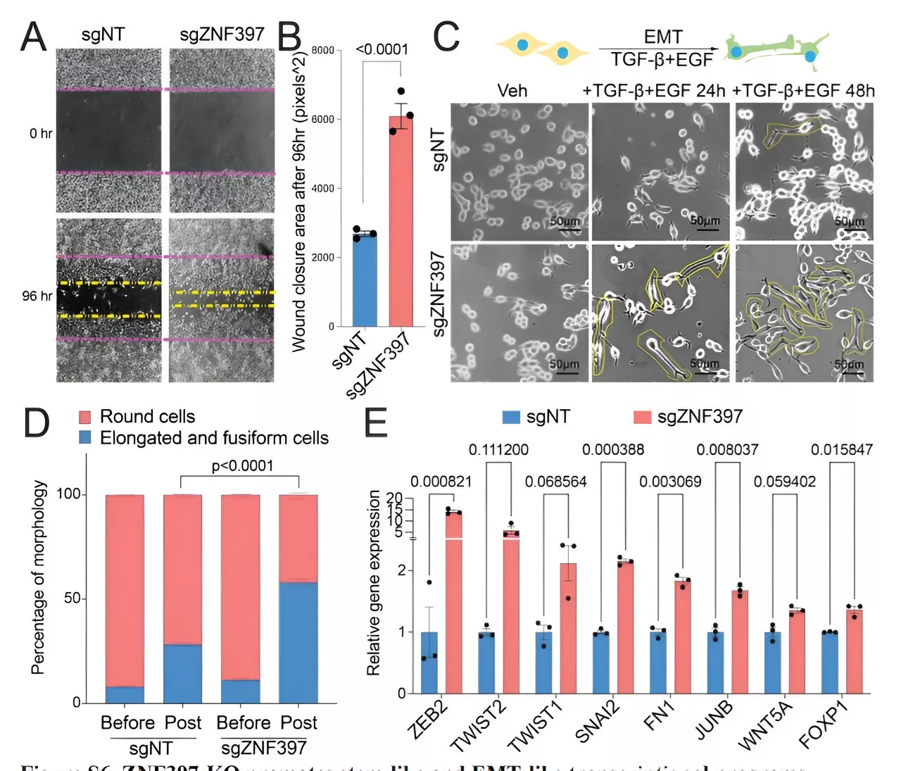 Prostate cancer study reveals molecular switch linked to lineage plasticity, therapy resistance