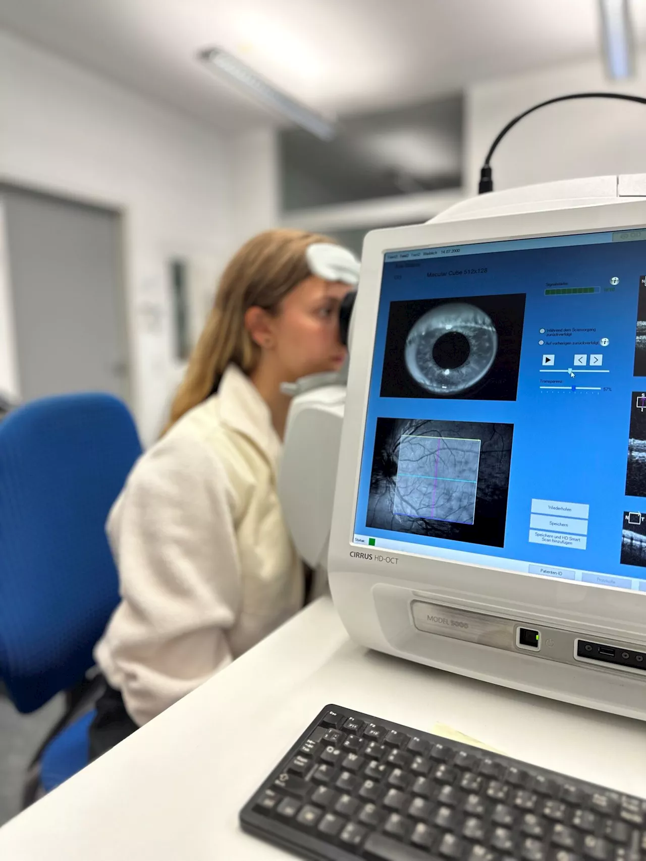 Retina indicates severity of schizophrenia, scientists discover