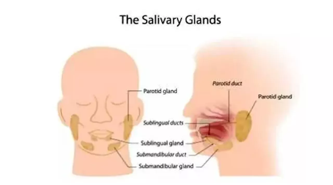 غده پاروتید یا غده بزاقی چیست؟ علائم + درمان