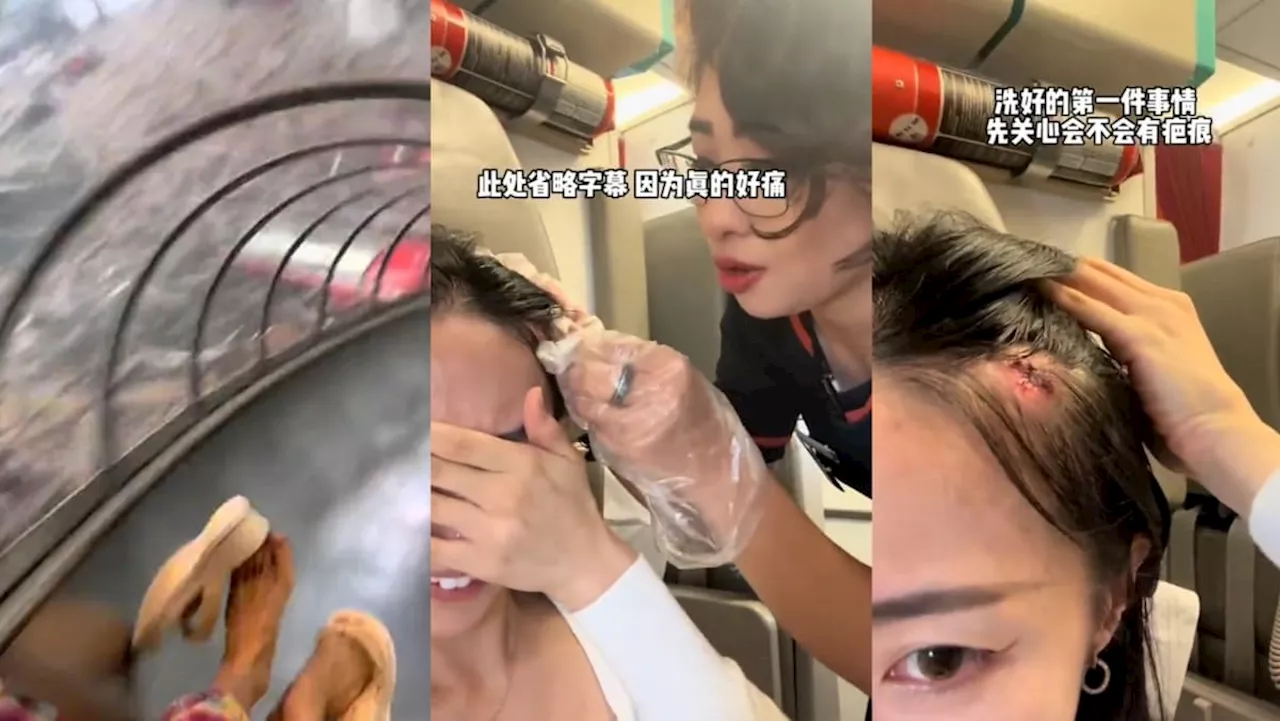 Influencer injures head while going down tube slide at Changi Airport T4