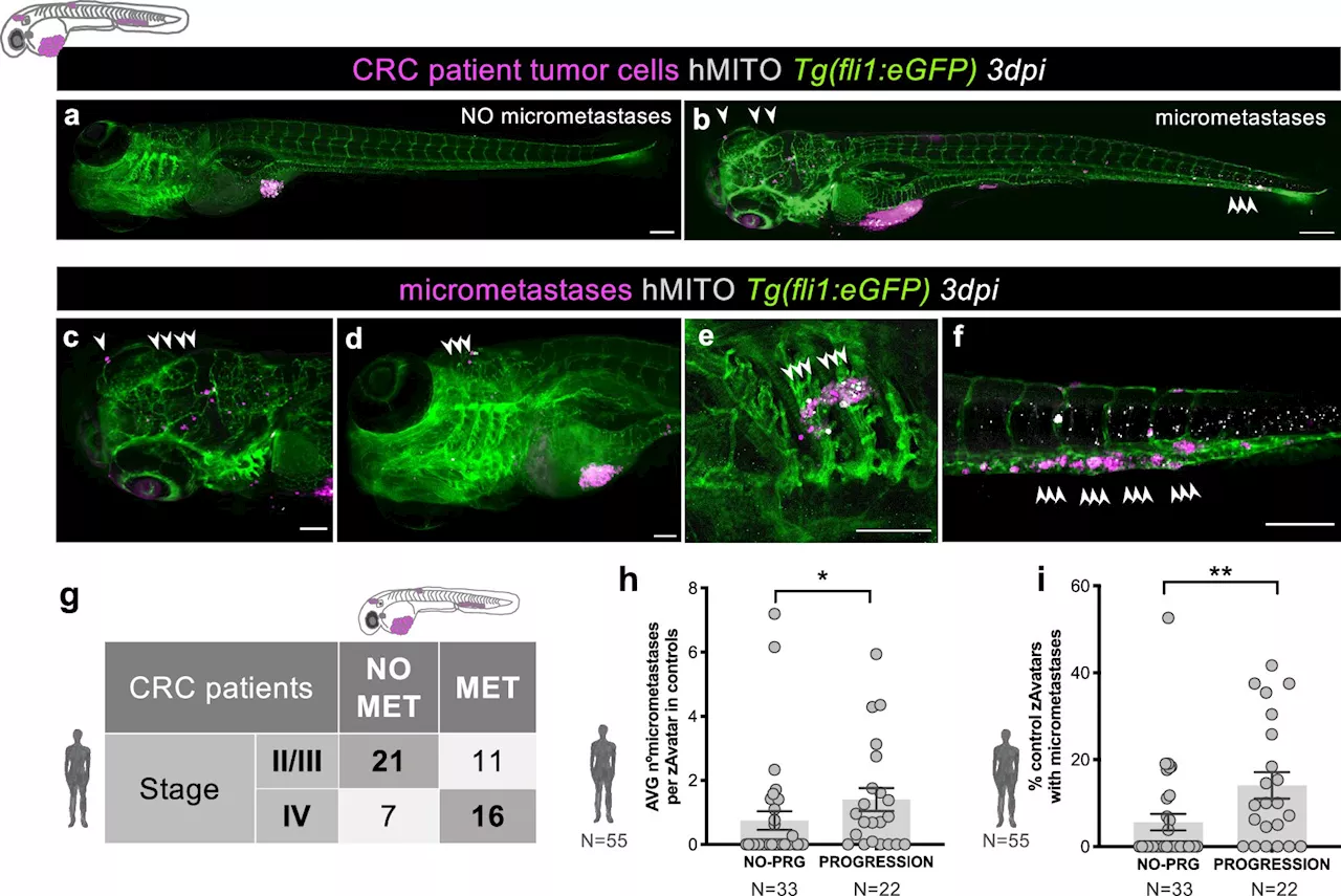 Clinical study shows zebrafish avatars of cancer patients have high predictive power