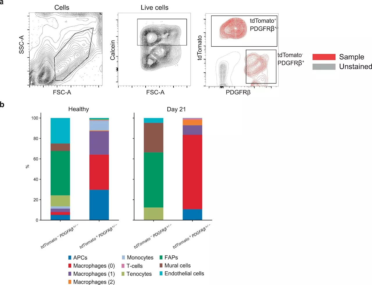 Macrophages behave like mural cells to promote healing of ischemic muscle injury, study shows
