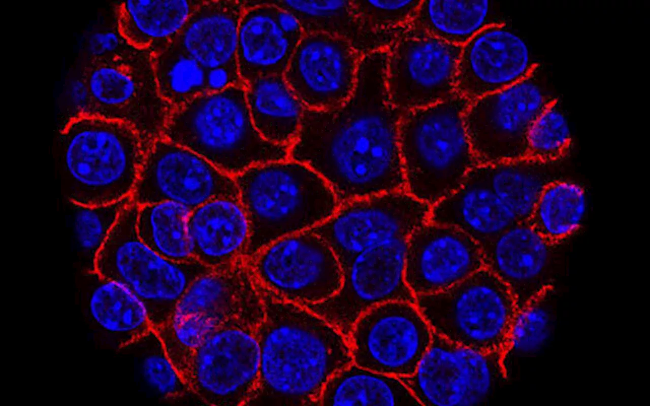 Researchers detail molecular pathway that impacts pancreatic cancer progression and treatment response