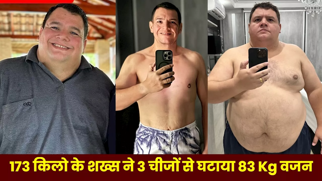 173 किलो के लड़के ने बिना सर्जरी के घटाया 83 Kg वजन, बताया कौन सी 3 चीजों से हुआ वेट लॉस