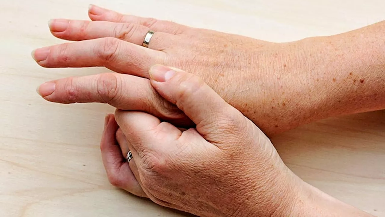 Having More Tender Than Swollen Joints Worsens Outcomes in Early Rheumatoid Arthritis