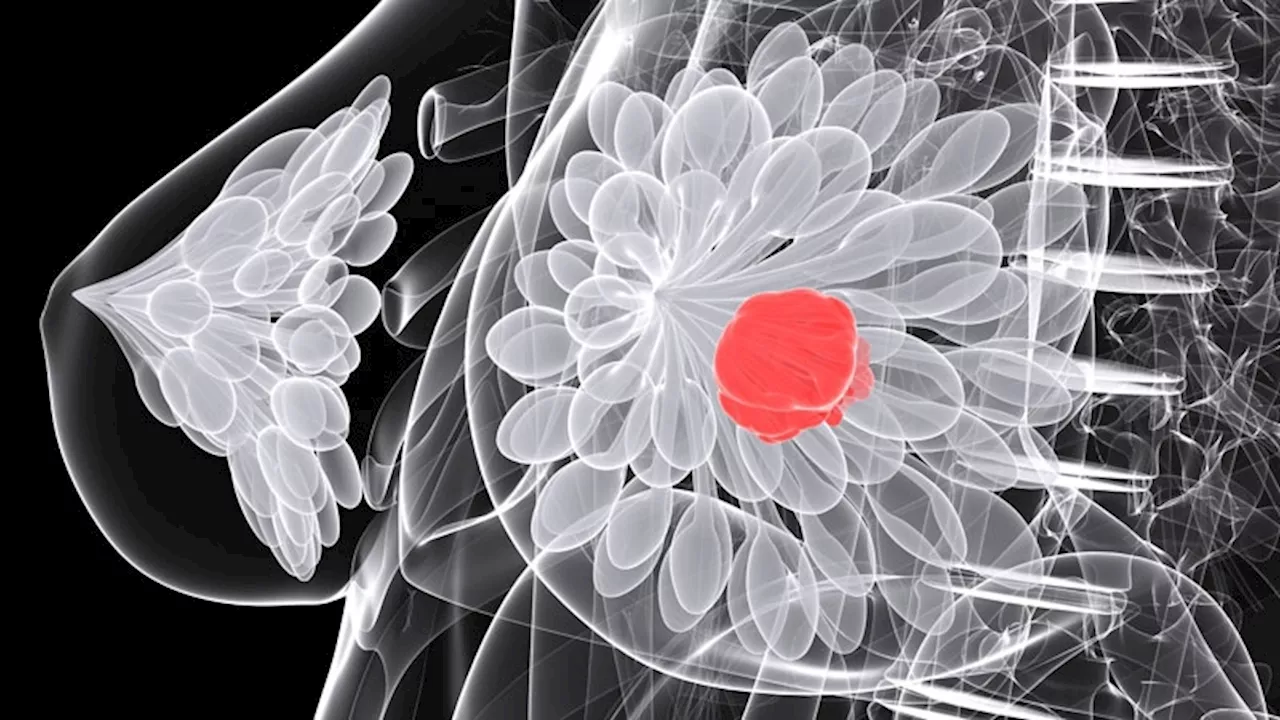 Should ER-Low Breast Cancer Patients Be Offered Endocrine Therapy?