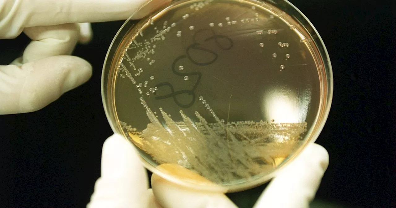 Urgent E. coli investigation after 113 reported cases linked to single outbreak