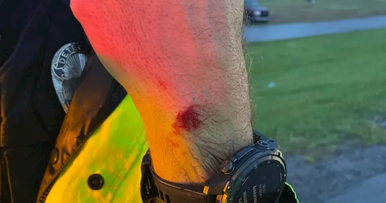 Officer suffered cut, torn pants during incident with golfer Scottie Scheffler