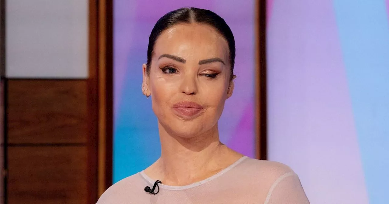 Loose Women's Katie Piper cancels show to undergo 'unexpected' procedure