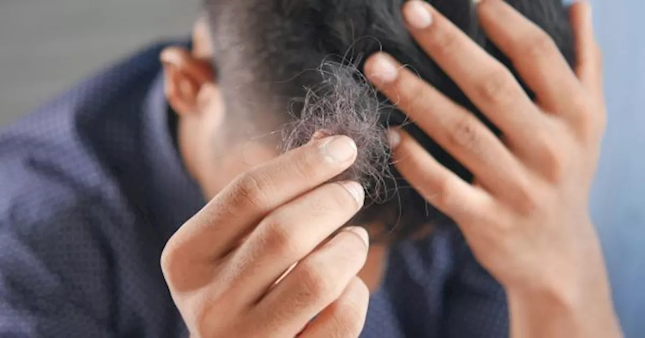 Estos son los PELIGROS que te exponés por NO LAVARTE EL PELO en varios días, según una dermatóloga