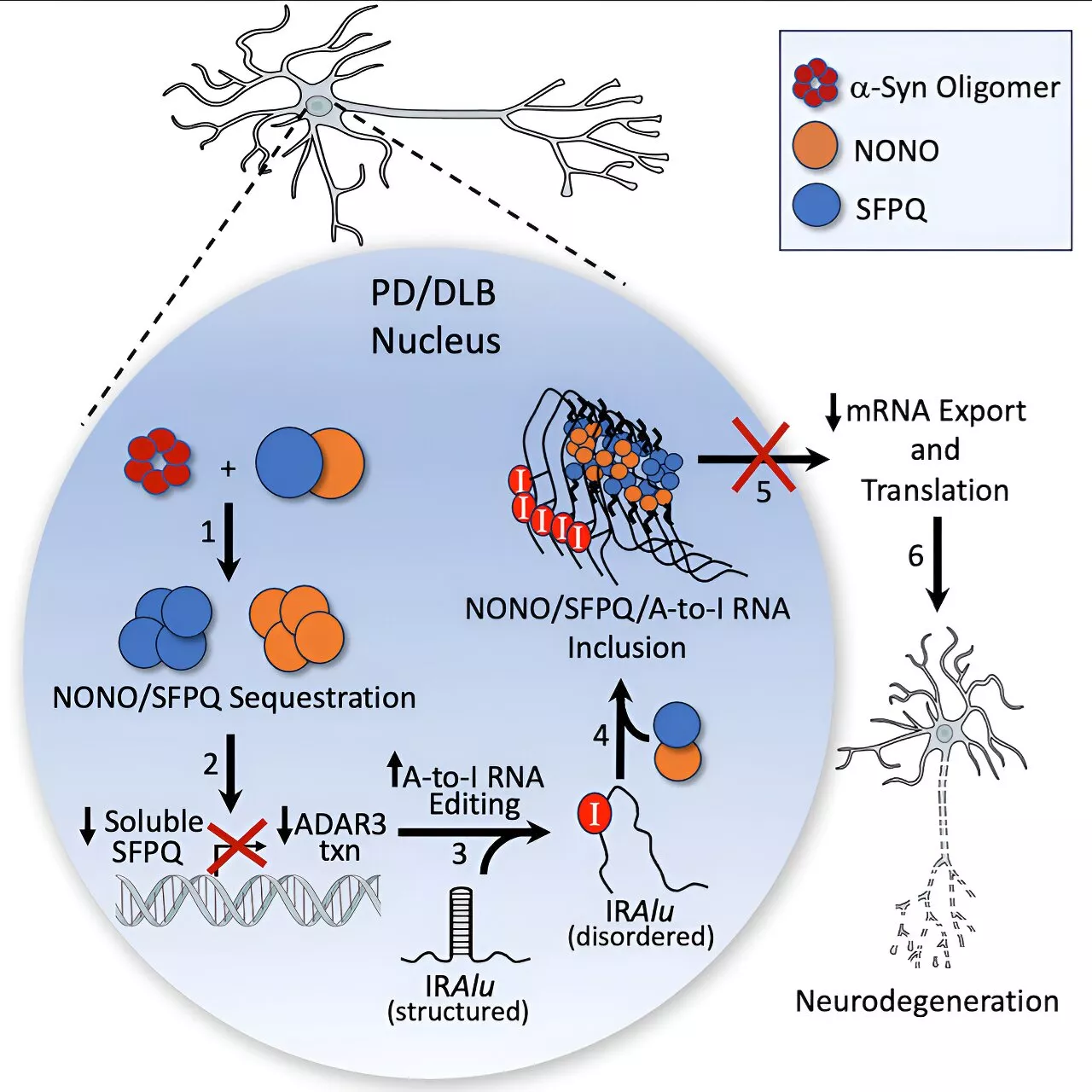 New cellular mechanisms in Parkinson's disease discovered