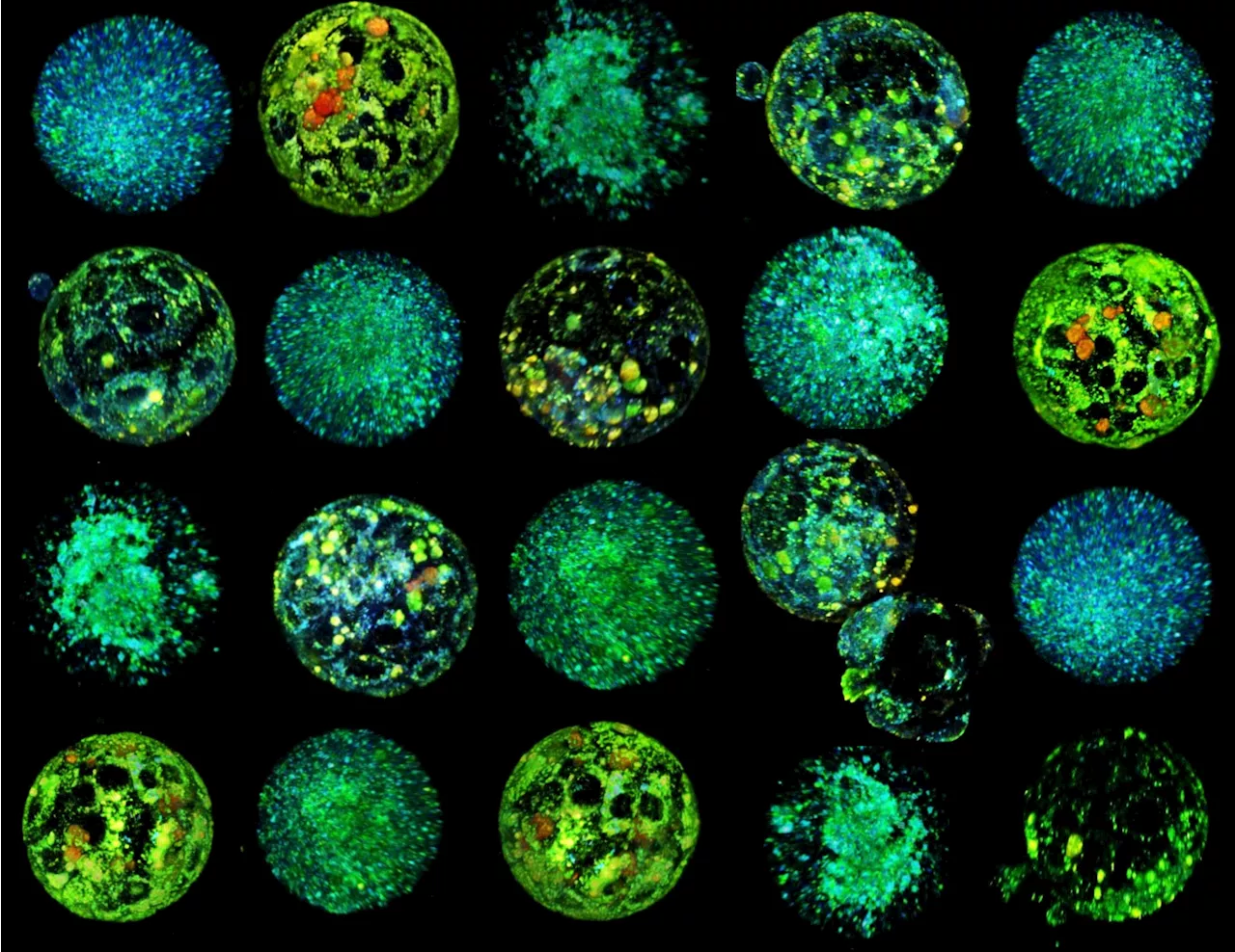 New technology visualizes embryo metabolism to improve IVF success