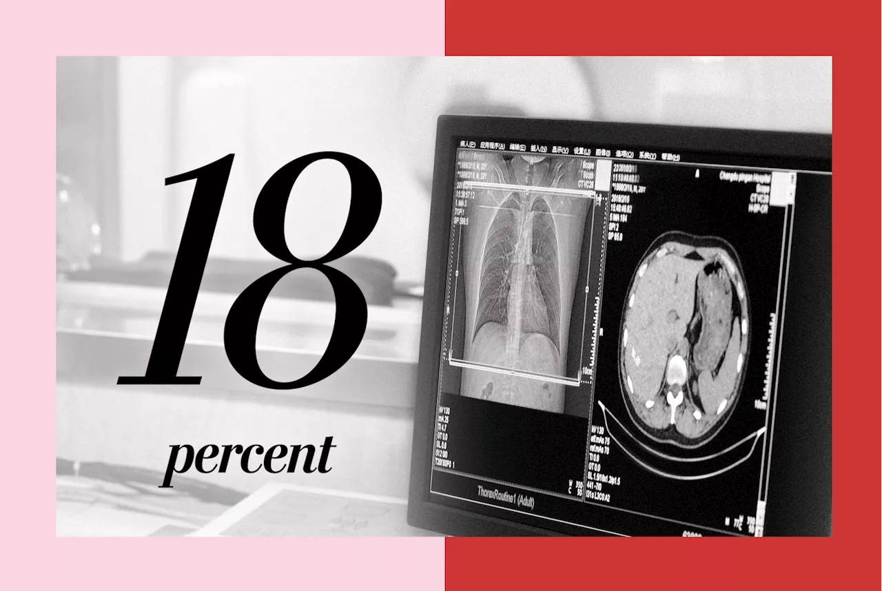 Fewer than 1 in 5 eligible Americans up to date with lung cancer screenings