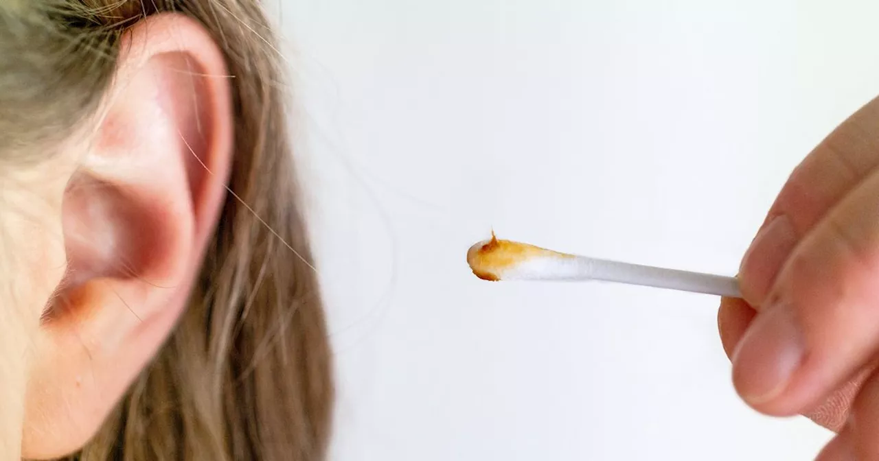 Colour and texture of your ear wax can tell you a lot about your health