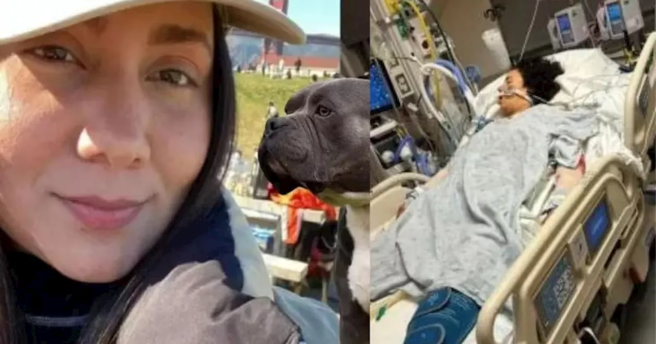 Habló la joven colombiana gravemente herida por sus perros en Estados Unidos