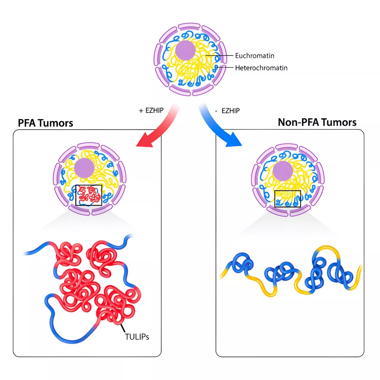 3D genome features point to possible therapeutic target for aggressive and deadly pediatric brain tumors