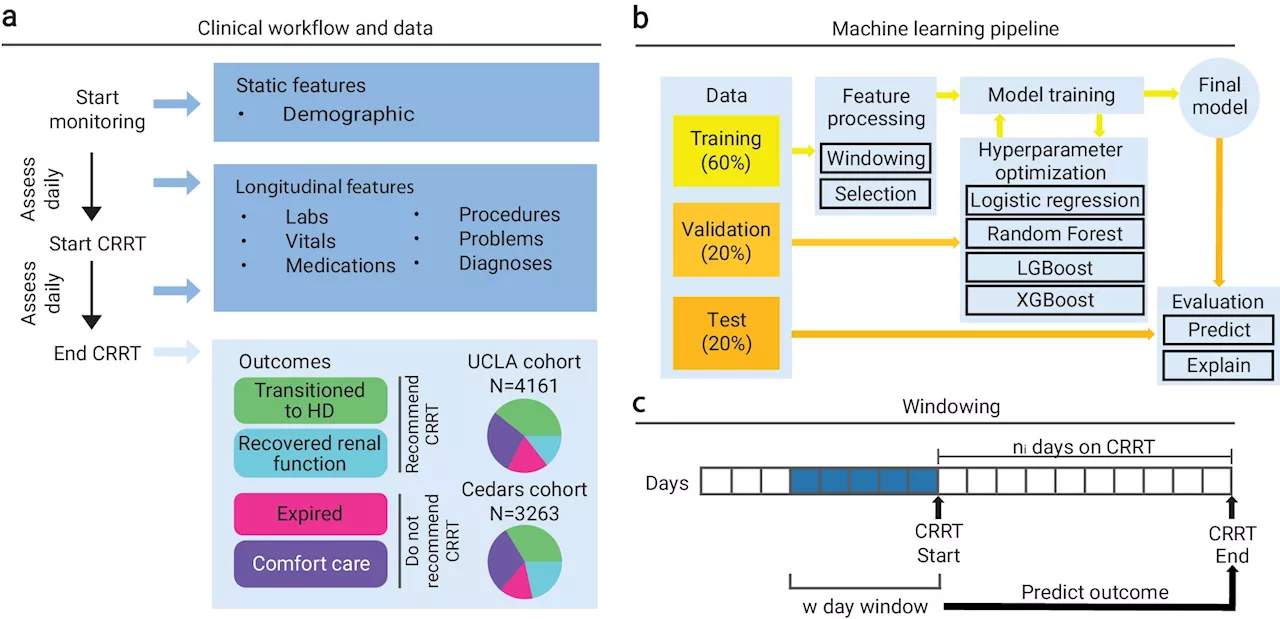 AI model can predict continuous renal replacement therapy survival