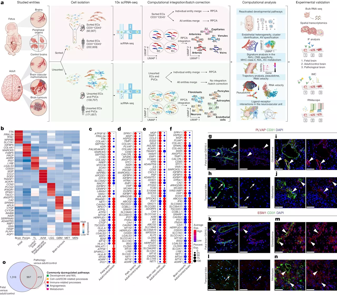 Researchers build first-ever molecular atlas of blood vessel pathways in human brain