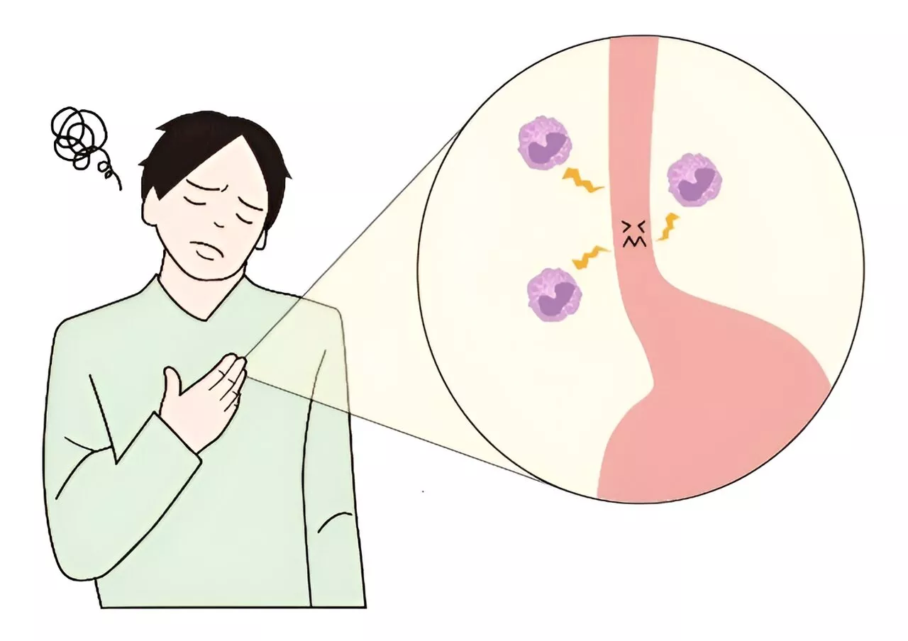 Rising incidence of chronic allergic disorder in Japan confirmed by large-scale data analysis