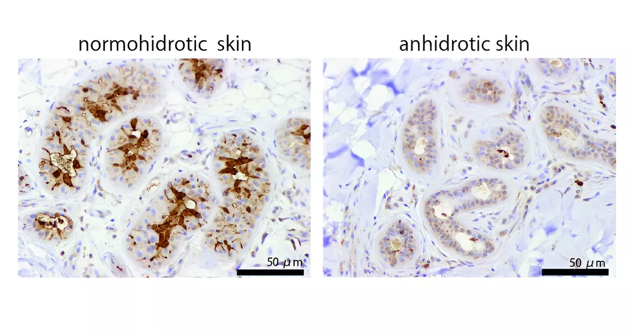 Study examines role of the gene TRPV4 in regulating perspiration in mice