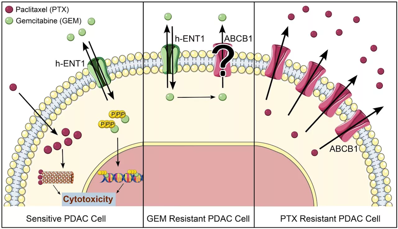 Targeting ABC transporters in pancreatic ductal carcinoma—past, present, or future?