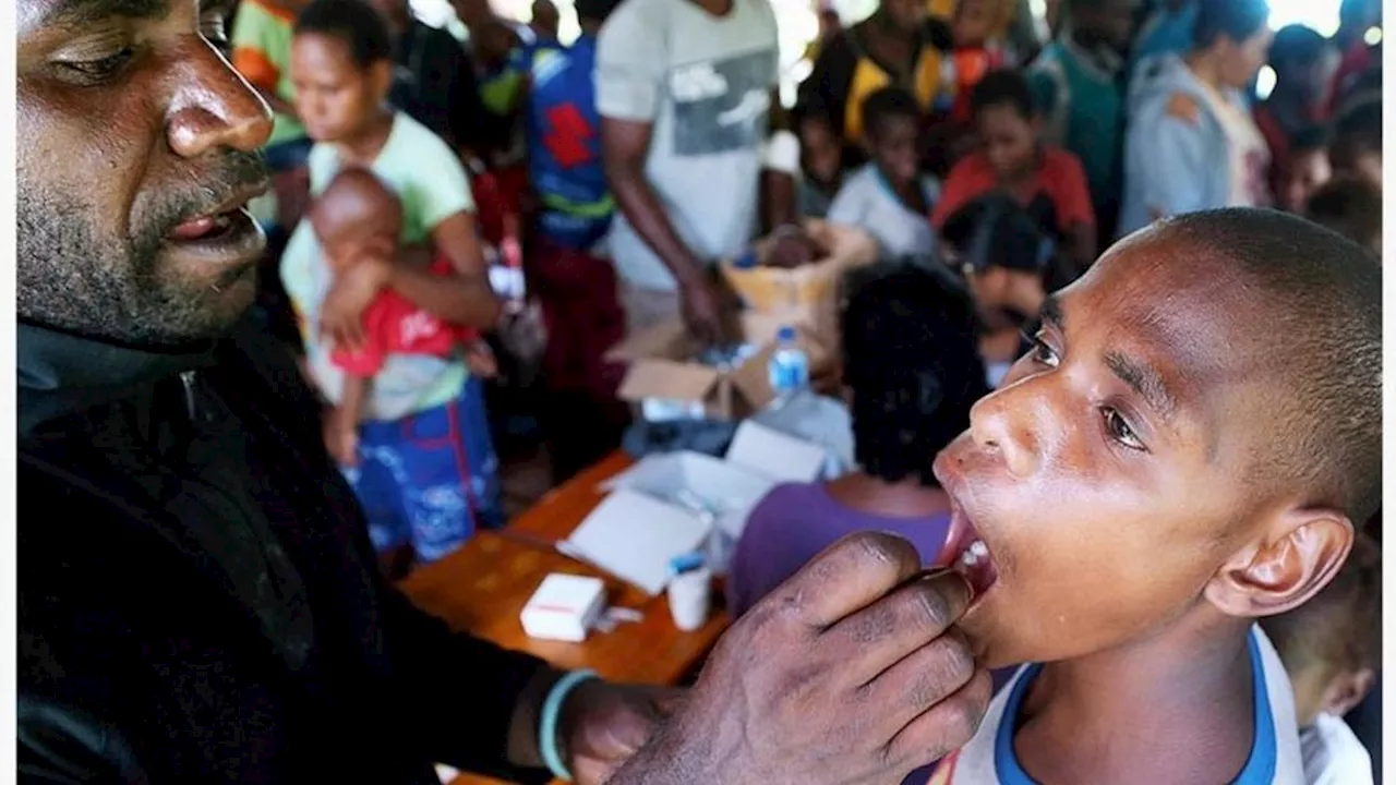 Warga di 15 Distrik Masih Mengungsi, Imunisasi Polio di Nduga Nihil Laporan