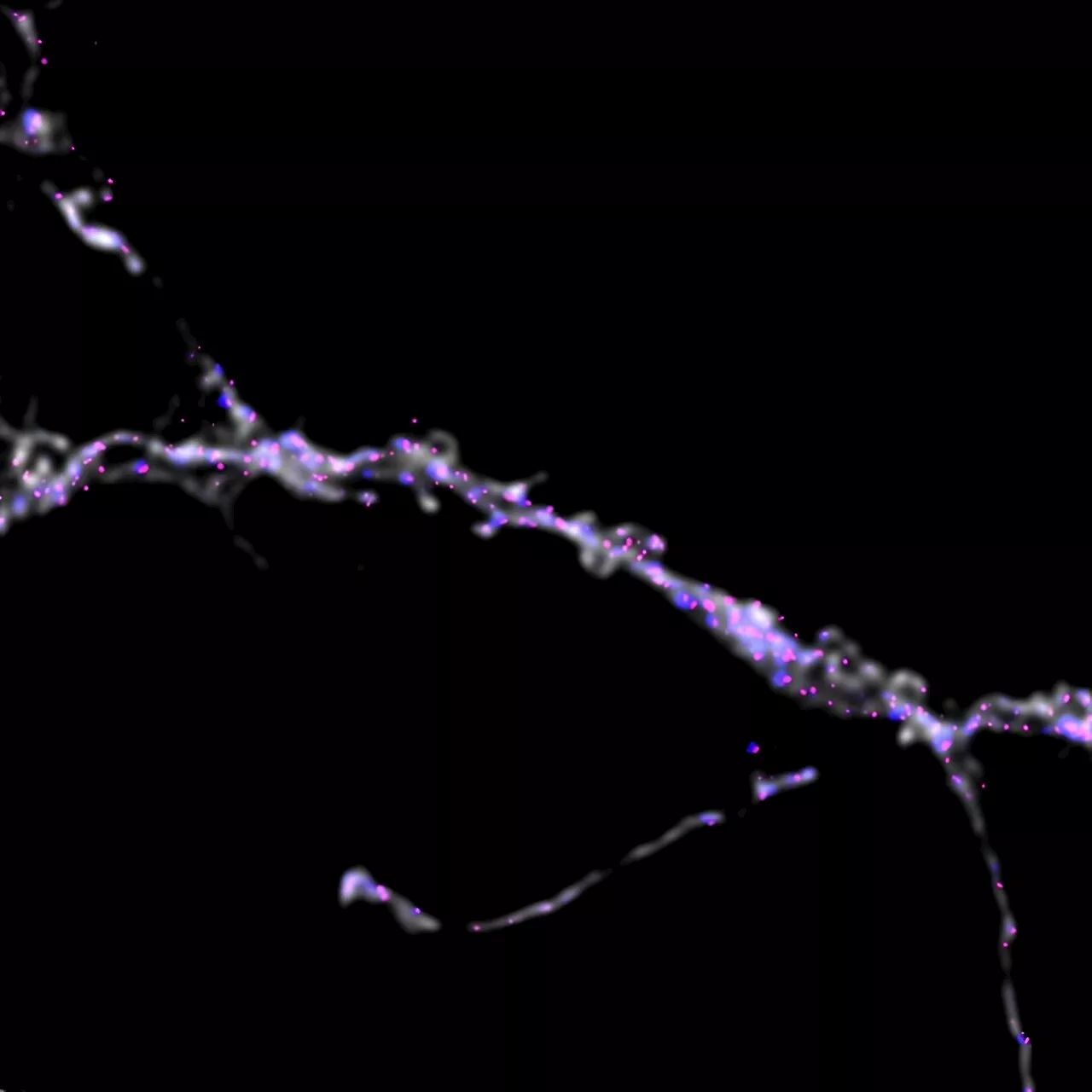 Molecular insights into cognitive impairment: New research uncovers how Parkinson's affects the brain