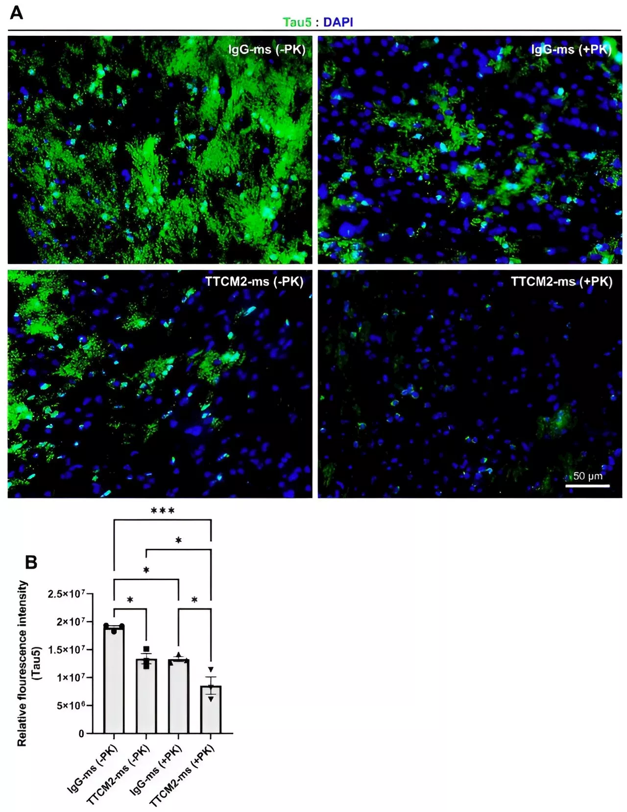 Nasal spray found to clear tau proteins from Alzheimer's mouse model brains