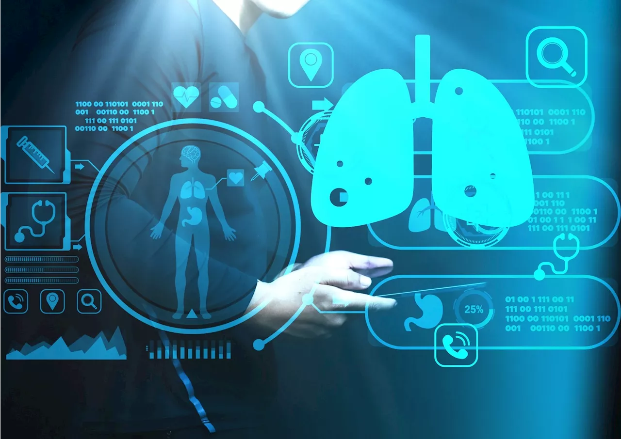 AI model accurately estimates pulmonary function from chest x-rays