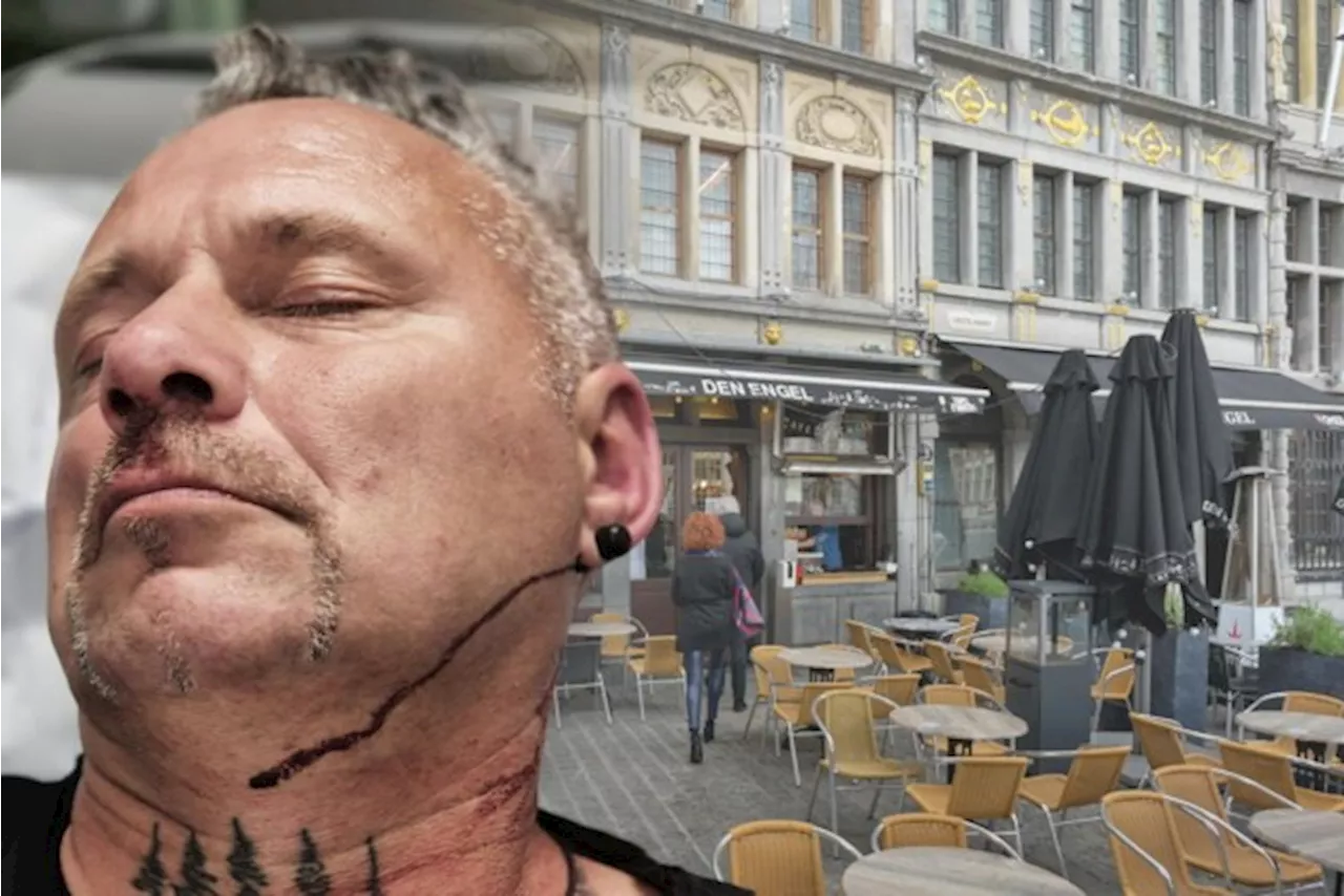 Onbekenden vallen Jerry (50) aan met hamer na banale discussie in centrum Antwerpen: “Nu pas besef ik aan wat