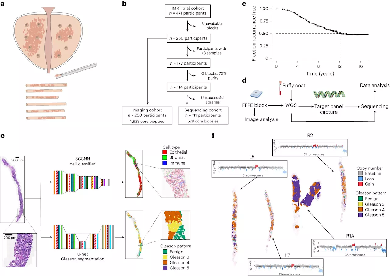 New tool combines evolution and AI to predict prostate cancer recurrence more than a decade ahead