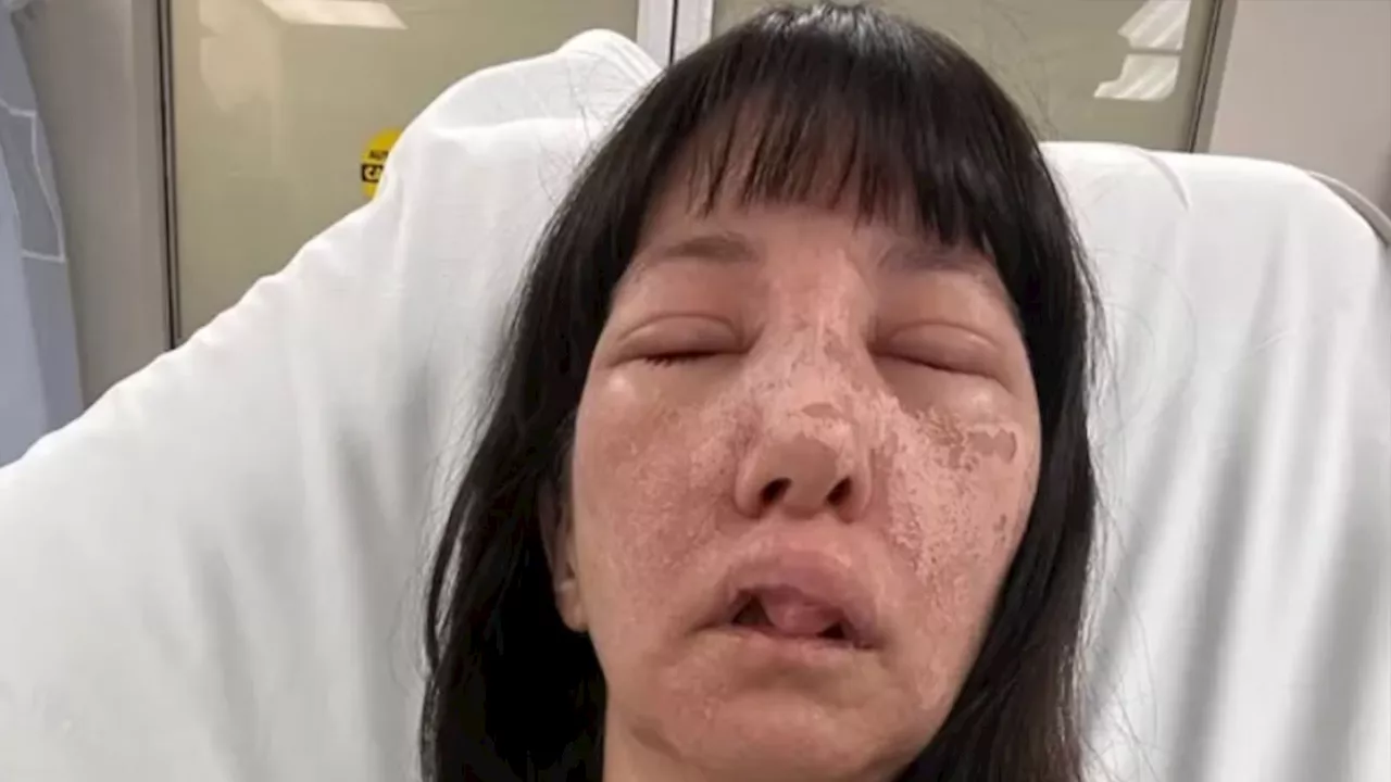 Mom, 44, attacked by pack of venomous spiders while cleaning as she’s left in eye patch with disturbing i...