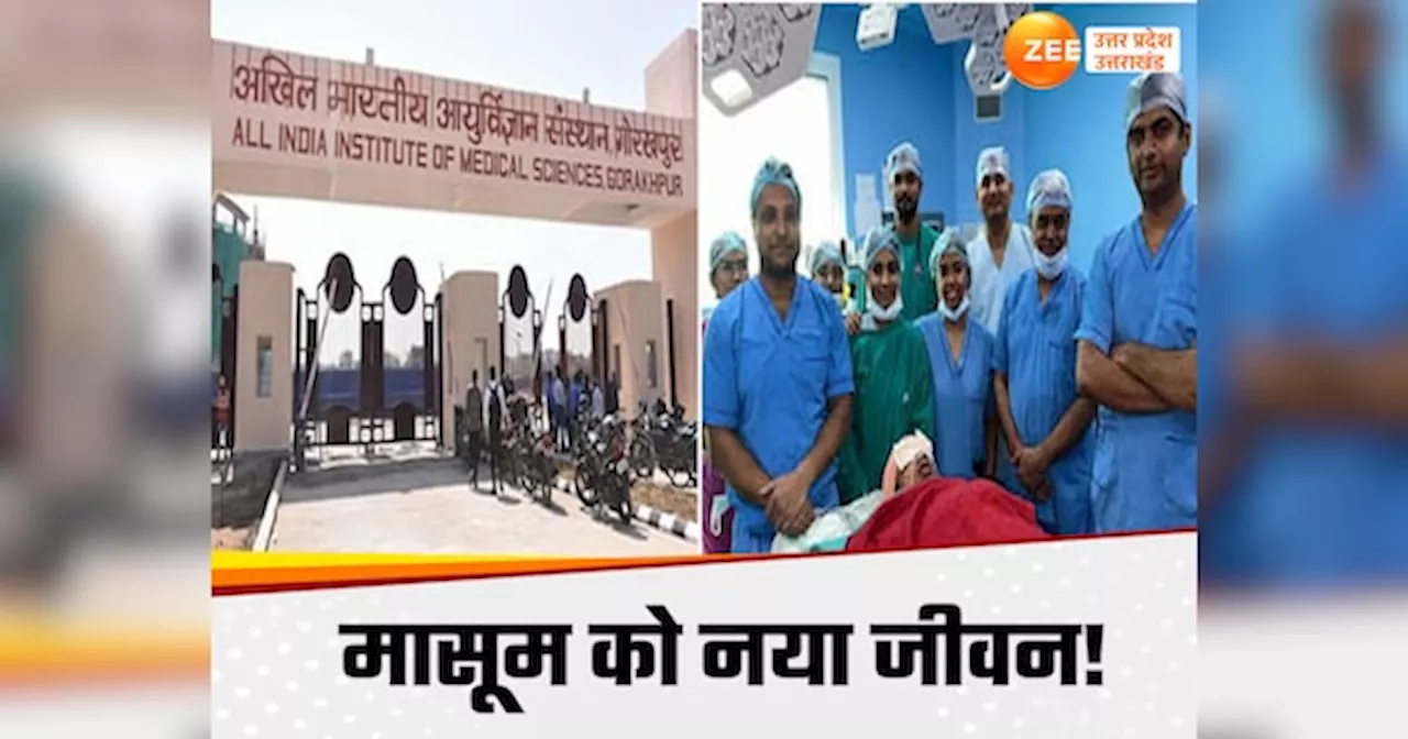 Gorakhpur AIIMS: दस साल से खा-पी नहीं पा रही बच्ची को गोरखपुर एम्स में मिला नया जीवन, जटिल सर्जरी से डॉक्टरों ने किया चमत्कार