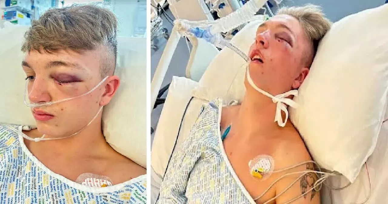 TRNSMT horror as teen in coma after 'head stamped on' at Glasgow Green festival