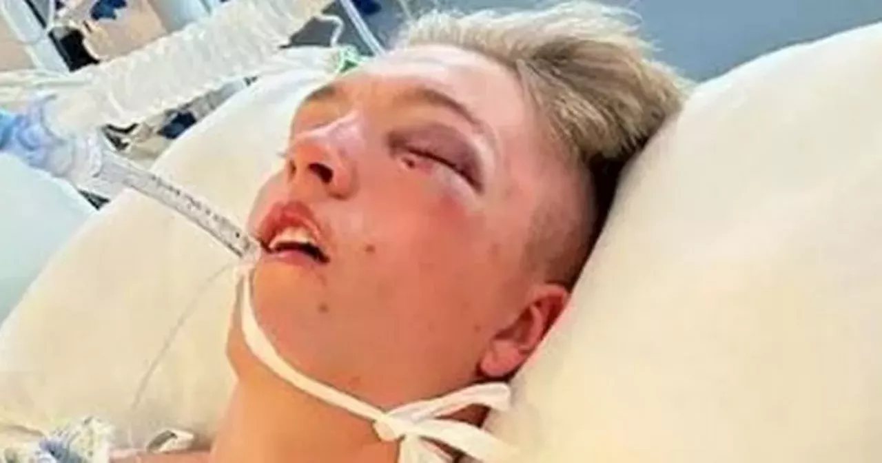 Teen in coma after brutal TRNSMT attack as head 'stamped on' in Glasgow Green