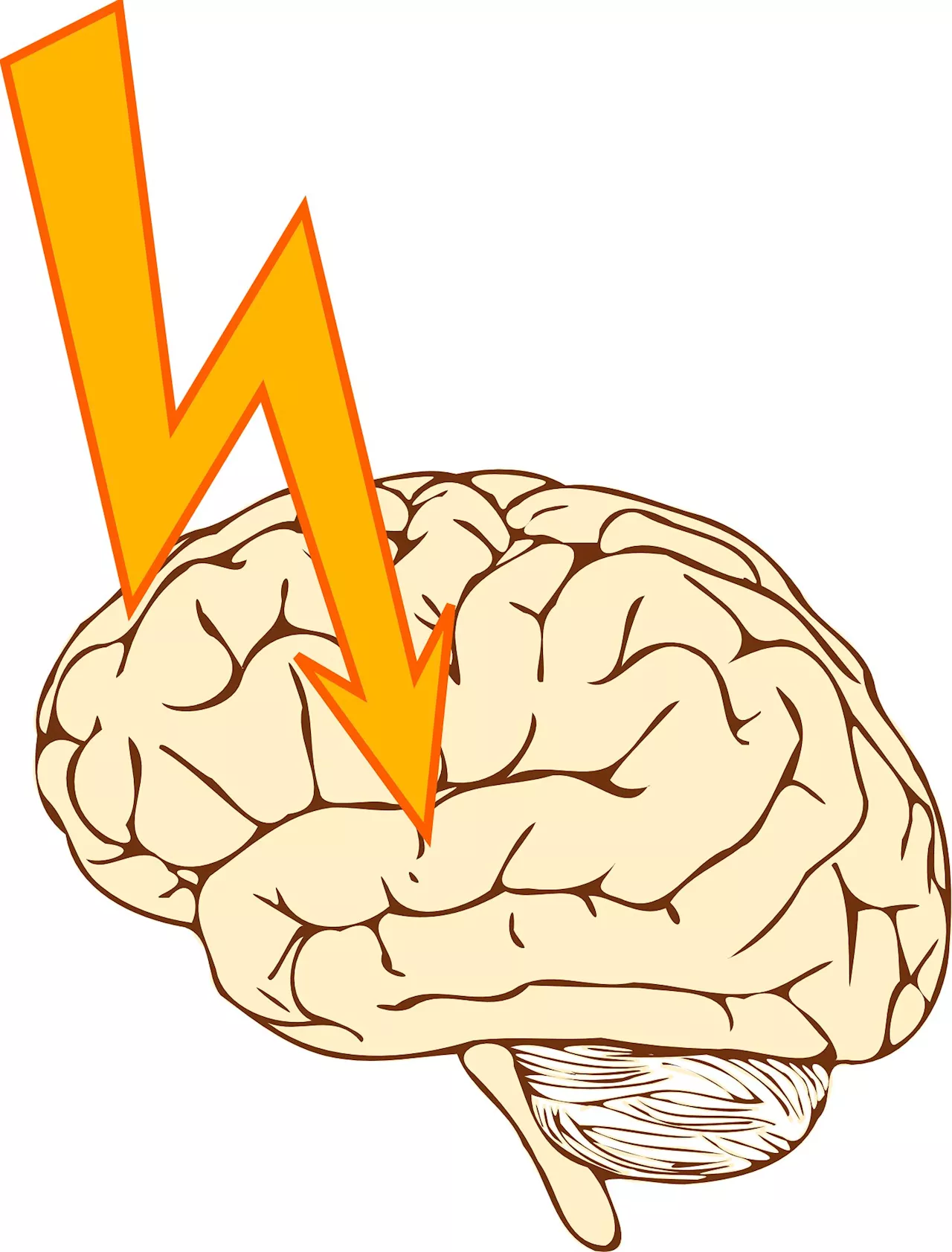 Study finds long-term stroke survival improving, but racial disparities remain